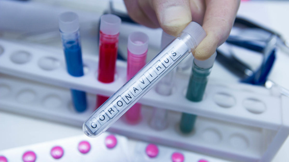 Ermenistan'da günlük vaka sayısındaki artış endişe yaratıyor